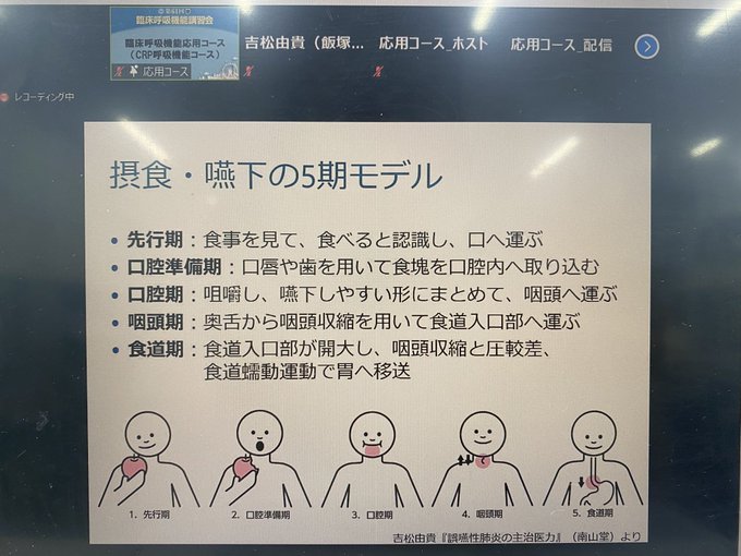 Yuki Yoshimatsu 誤嚥性肺炎の主治医力 Yukiy0105 Nitter