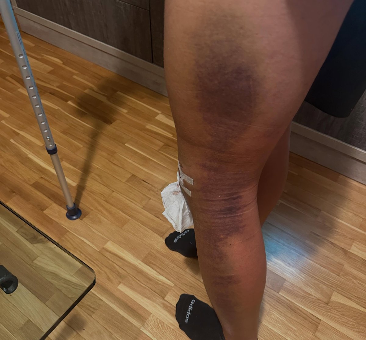 Beñat Prados comparte fotos de su recuperación…